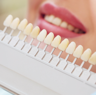 Teeth for implant Teeth for implant